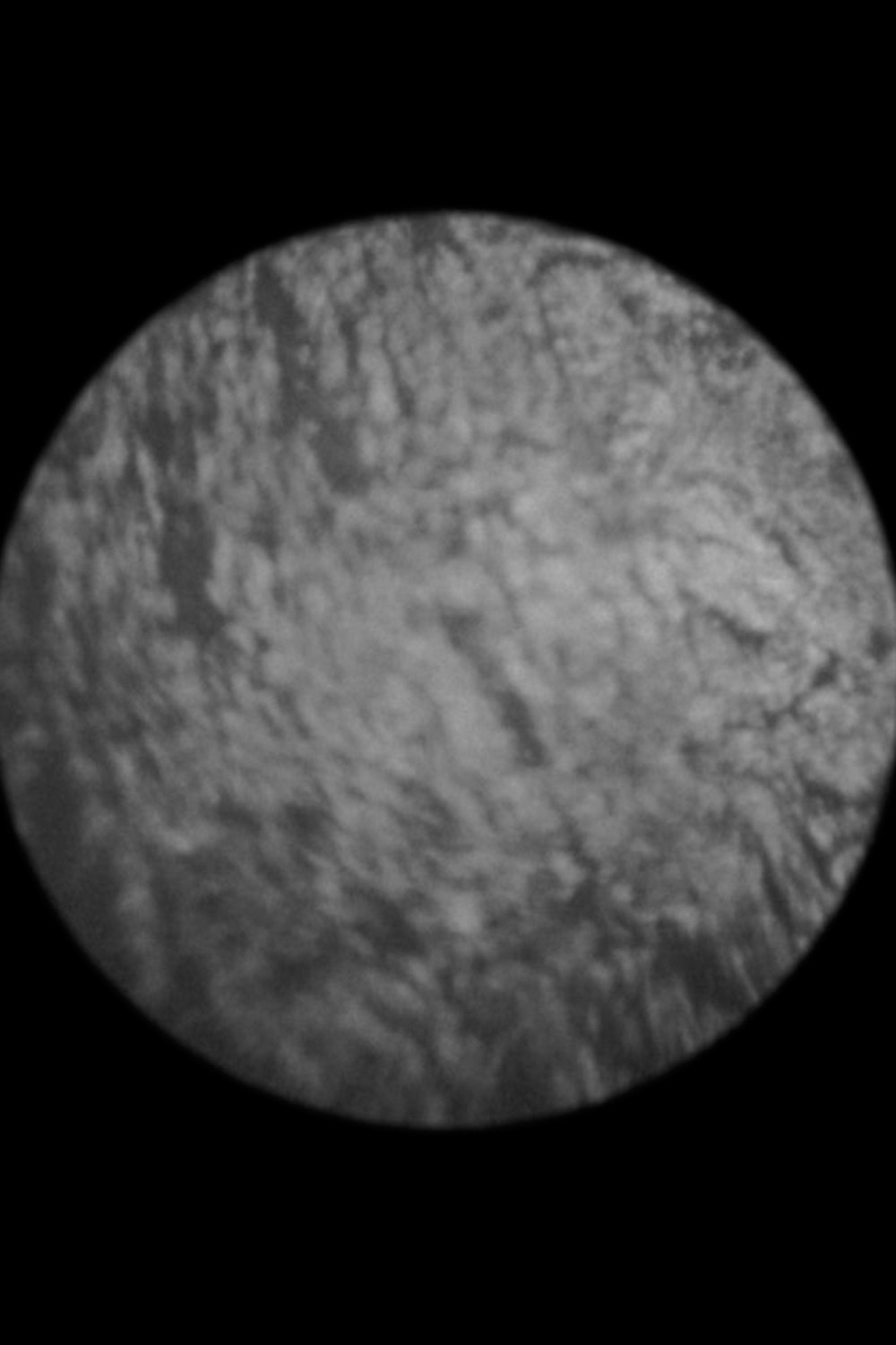 Orbita cover