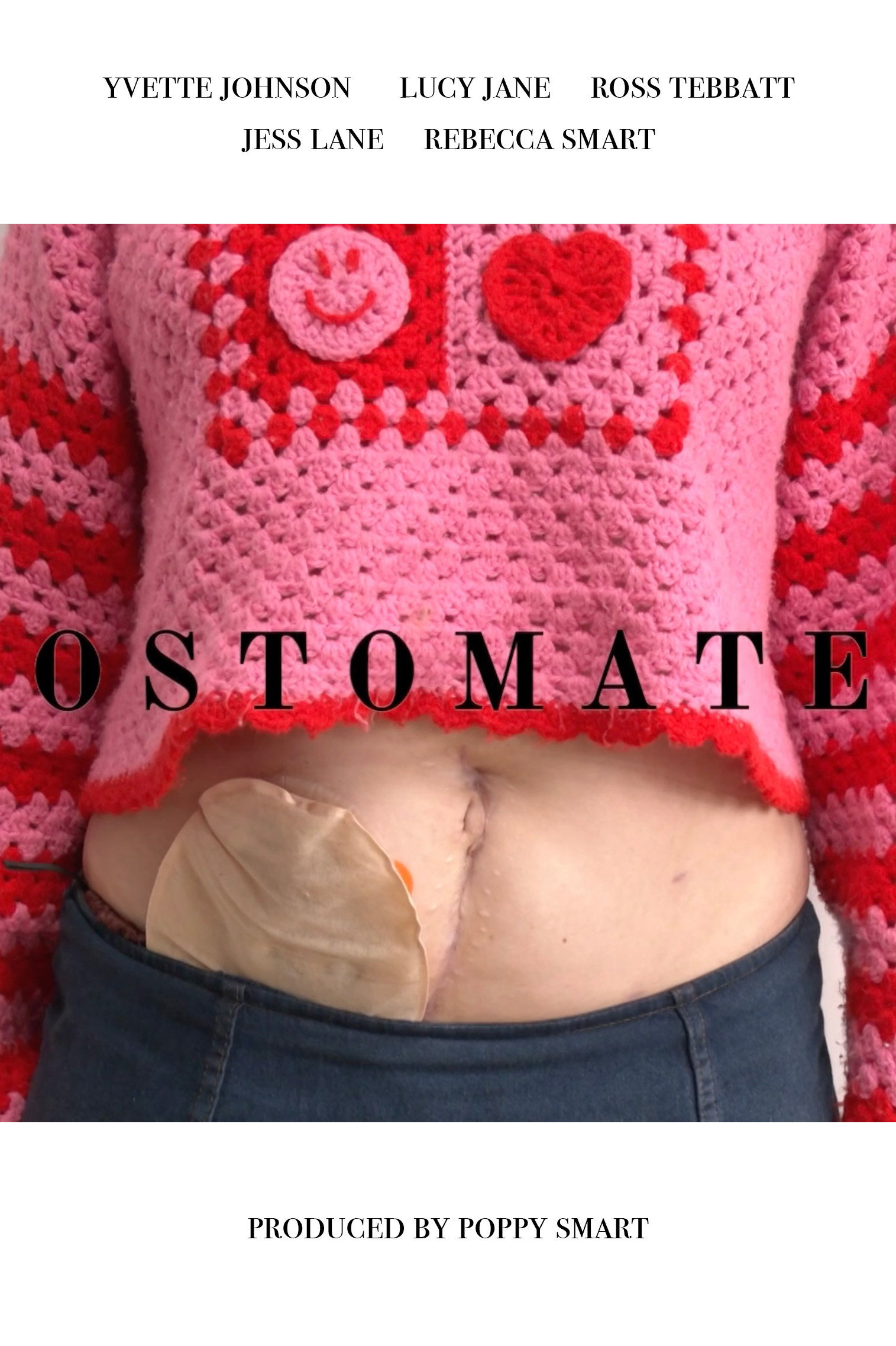 Ostomate cover